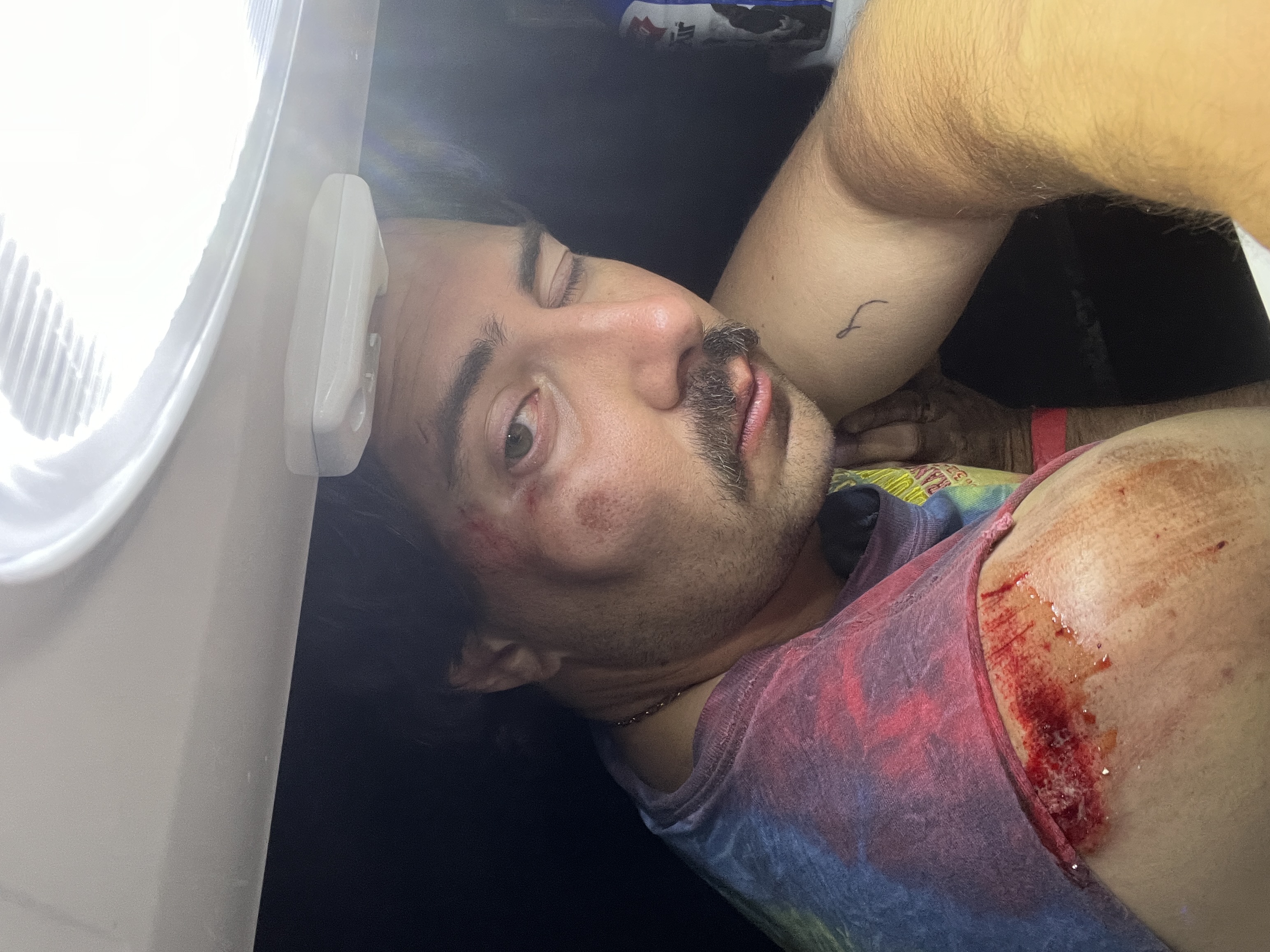 Enzo's Accident
